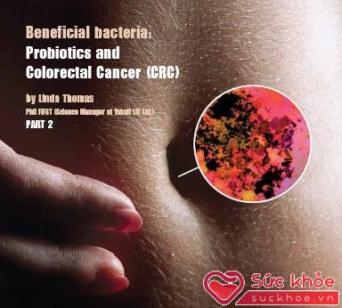 Một lớp biểu bì có vi khuẩn staphylococus phổ biến trên da người khỏe mạnh có thể được chọn lục để ức chế sự phát triển của một số bệnh ung thư