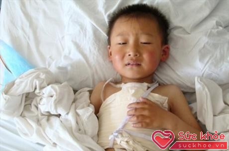 Trẻ bị tim bẩm sinh nếu không được chữa trị kịp thời sẽ ảnh hưởng đến sự phát triển của trẻ (Ảnh minh họa: Internet)