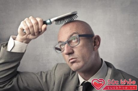 Rụng tóc quá nhiều là dấu hiệu rối loạn về hoóc-môn của nam giới (Ảnh minh họa: Internet)