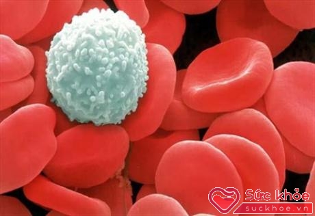 Các tế bào bạch cầu 'tấn công' hồng cầu gây mất sự cân bằng