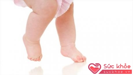 Trẻ đi kiễng chân có thể là dấu hiệu mắc bệnh tự kỷ