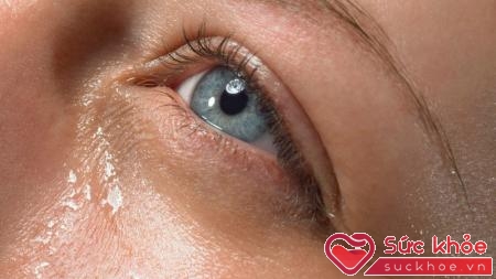 Parkinson là 1 trong những bệnh có thể được chẩn đoán qua nước mắt