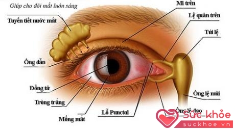 Tắc tuyến lệ có thể gây nhiều gỉ mắt.