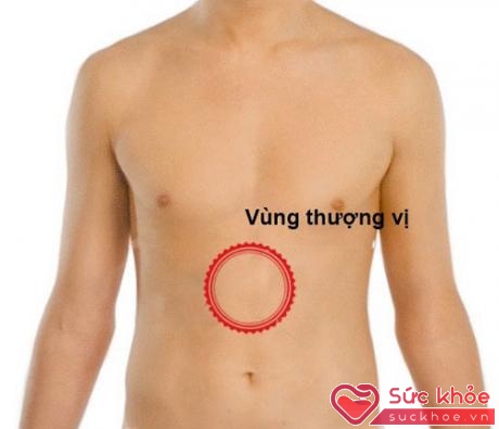 Đau vùng bụng trên rốn (đau vùng thượng vị) là dấu hiệu biểu hiện ra bên ngoài sớm nhất của bệnh