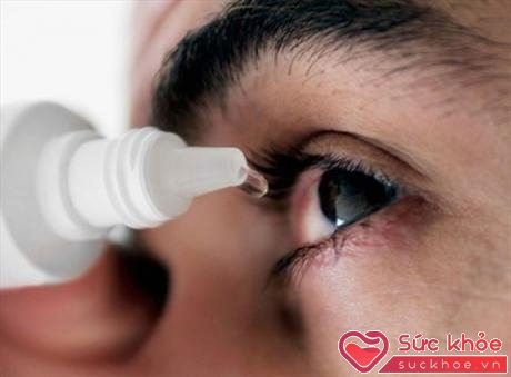 Đau mắt đỏ là một bệnh dễ lây lan và có thể thành dịch
