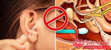 Thường xuyên dùng bông tăm để ngoáy tai là hoạt động tốt giúp loại bỏ các chất bẩn bên trong
