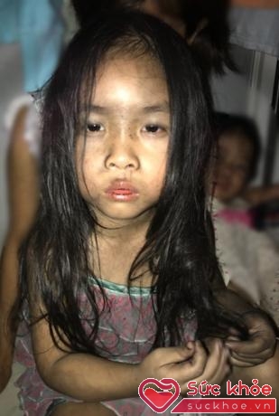Bé gái 4 tuổi sau khi được mẹ cứu thoát.