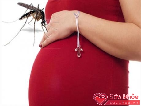 Sốt xuất huyết khi mang thai thường khó chẩn đoán hơn người bình thường