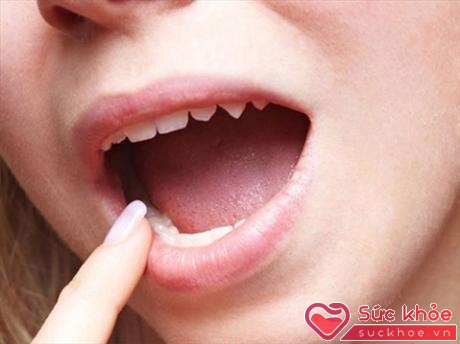 Nếu bạn không uống đủ nước, dấu hiệu đầu tiên là khô miệng