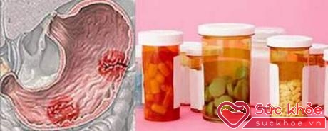 Cần dùng thuốc chống axit trong điều trị đau dạ dày theo đúng chỉ định của bác sĩ