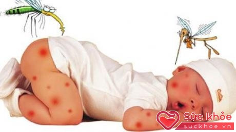 Muỗi truyền bệnh sốt xuất huyết gây nguy hiểm cho trẻ em