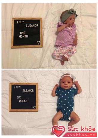 Chị Talley vui mừng thông báo bé Lucy 6 tuần tuổi đã tăng gần 1kg sau khi tìm ra nguyên nhân thực sự và được làm thủ thuật cắt một phần thắng lưỡi.
