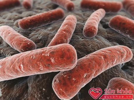Vi khuẩn Mycobacterium tuberculosis gây lao phổi