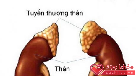 Suy tuyến thượng thận dẫn đến rối loạn các quá trình chuyển hóa trong cơ thể.