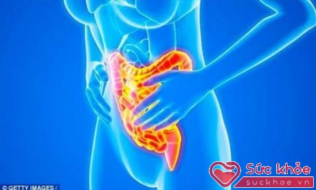 Những biến chứng của bệnh Crohn bao gồm suy dinh dưỡng, loét và tắc ruột.