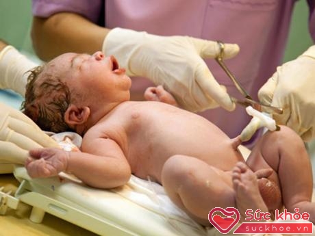 Sử dụng tế bào gốc máu từ dây rốn trẻ sơ sinh.