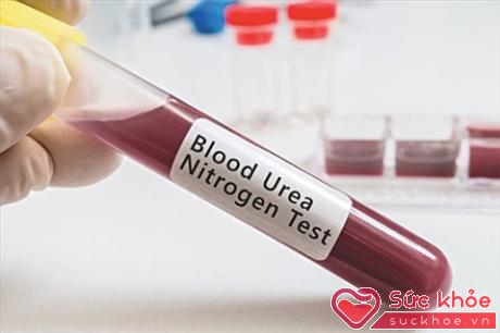Người ta làm xét nghiệm urê máu bằng các biện pháp loại bỏ amoniac bằng lọc máu.
