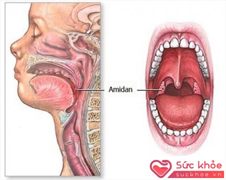 Ung thư biểu mô vòm họng thường được chẩn đoán phổ biến ở những người từ 30 đến 60 tuổi. 