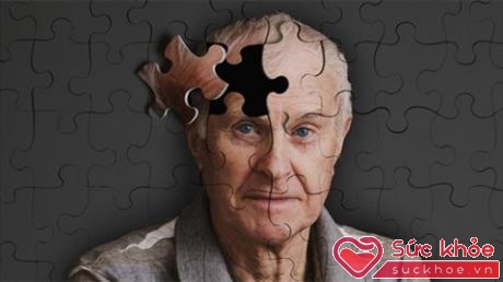 Những người trưởng thành bị trầm cảm có khả năng bị bệnh Alzheimer