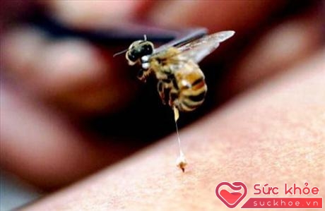 Nọc ong có thể trị bệnh viêm khớp.