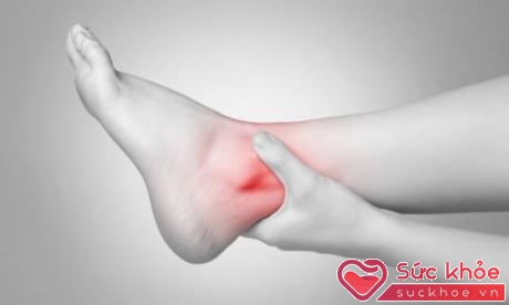 Thoái hóa khớp cổ chân là hậu quả của việc mất cân bằng giữa việc tổng hợp và hủy hoại của sụn và phần xương dưới sụn ở cổ chân.