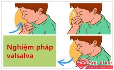 Nghiệm pháp Valsalva giúp nhịp tim dần dần hạ xuống.