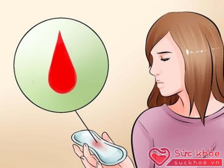 Bạn cần nắm được chính xác đặc điểm chu kỳ kinh nguyệt hằng tháng của mình để biết khi nào bị chảy máu bất thường
