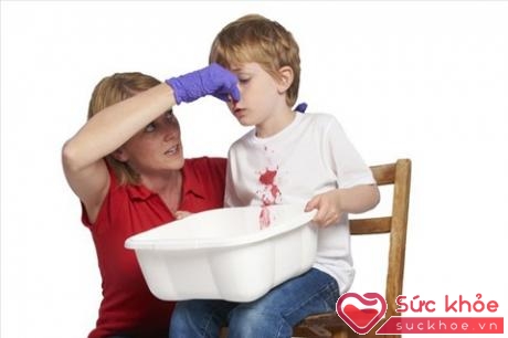 Yêu cầu trẻ xì mũi nhẹ nhàng để loại bỏ các cục máu đông đã hình thành bên trong mũi (Ảnh minh họa).