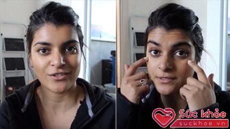 Trước và sau khi thoa hỗn hợp baking soda, vùng da dưới mắt của vlogger này không hề có sự khác biệt nhiều.