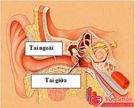 Viêm tai giữa do nhiều nguyên nhân gây ra, có thể tự phát do viêm nhiễm vùng mũi họng hoặc do vi khuẩn, virut từ bên ngoài xâm nhập vào tai.