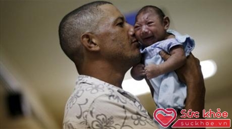 Vi-rút Zika gây bệnh đầu nhỏ ở trẻ (ảnh: Internet)
