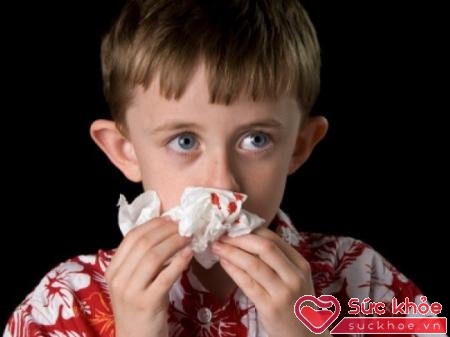 Chảy máu mũi là triệu chứng sốt xuất huyết ở trẻ em