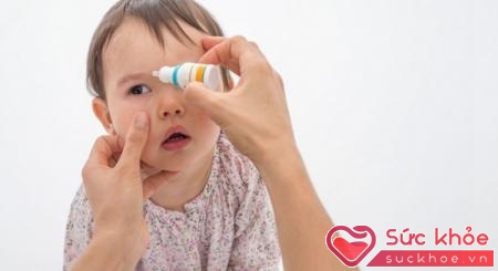 Dùng các loại thuốc nhỏ mắt theo chỉ dẫn sẽ giúp trả lời câu hỏi: Đau mắt đỏ dùng thuốc gì?