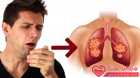 Thở khò khè là một trong những dấu hiệu ung thư phổi