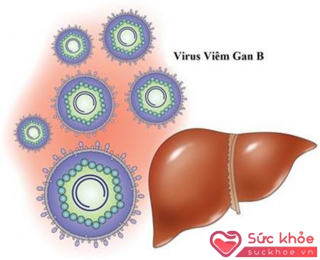 Điều trị viêm gan b mạn tính thế nào được nhiều người quan tâm