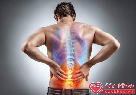 Cách chữa đau lưng nhanh nhất từ những dược llệu quanh ta