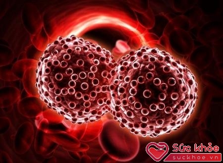 Ung thư máu cấp tính là một căn bệnh nguy hiểm