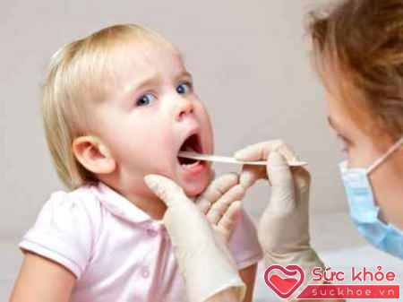 Cần phát hiện sớm các triệu chứng viêm họng ở trẻ em