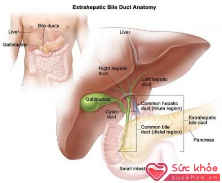 Có nhiều cách chữa sỏi mật hiệu quả