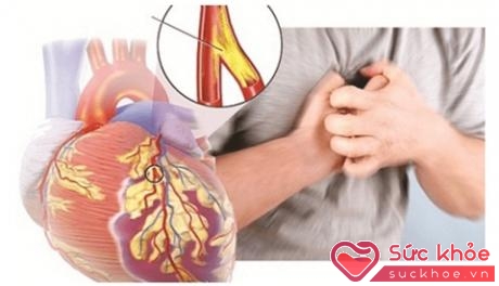 Nhồi máu cơ tim: thời gian phát hiện và can thiệp là Vàng 