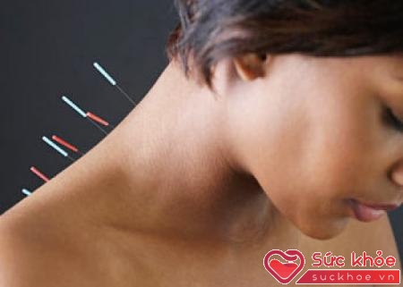 Chữa đau nửa đầu vai gáy cần vạch ra liệu pháp điều trị rõ ràng