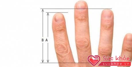 Chiều dài của ngón tay phản ánh sức khỏe con người
