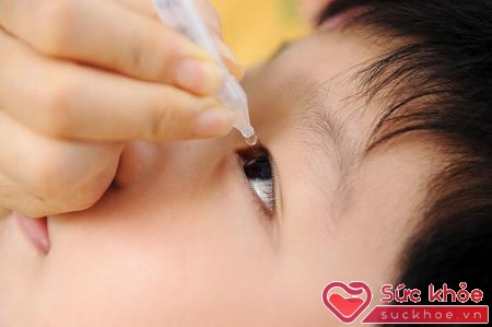 Cách chữa đau mắt hột có thể dùng thuốc tra mắt, trị các biến chứng...