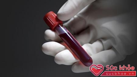 Xét nghiệm máu có thể xác định được tình trạng suy hô hấp