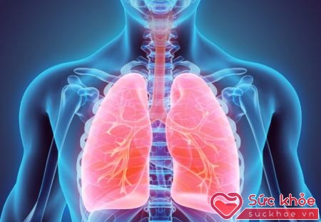 Viêm phế quản phổi hay gặp ở bệnh nhân suy hô hấp nằm lâu, không dẫn lưu tư thế và thay đổi tư thế