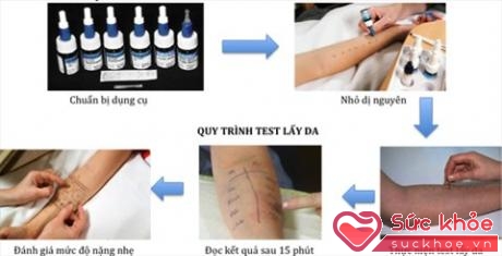 Quy trình test lẩy da theo quy định của ngành y tế 