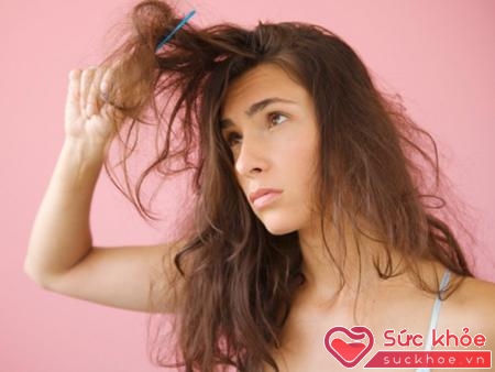 Rụng tóc nhiều ở nữ là hiện tượng phổ biến hiện nay