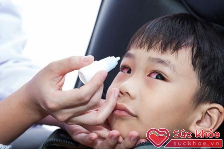 Trẻ bị cảm lạnh thường có các dấu hiệu như mắt đỏ, ngạt mũi