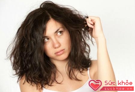Chất lượng máu kém, rối loạn nội tiết tốt đều gây rụng tóc