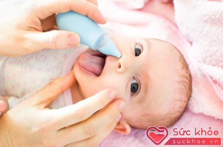 Hút mũi là cách hiệu quả để khai thông đường thở cho trẻ